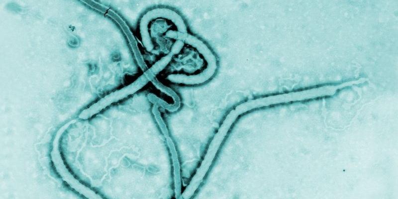 Wirus Ebola pod mikroskopem. - fot. 