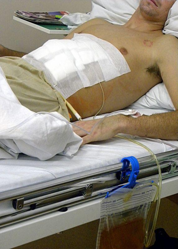 Po zajściu na dyskotece Kamil cudem uszedł z życiem. Na zdjęciu po operacji w łukowskim szpitalu. Fot. PGL - fot. 